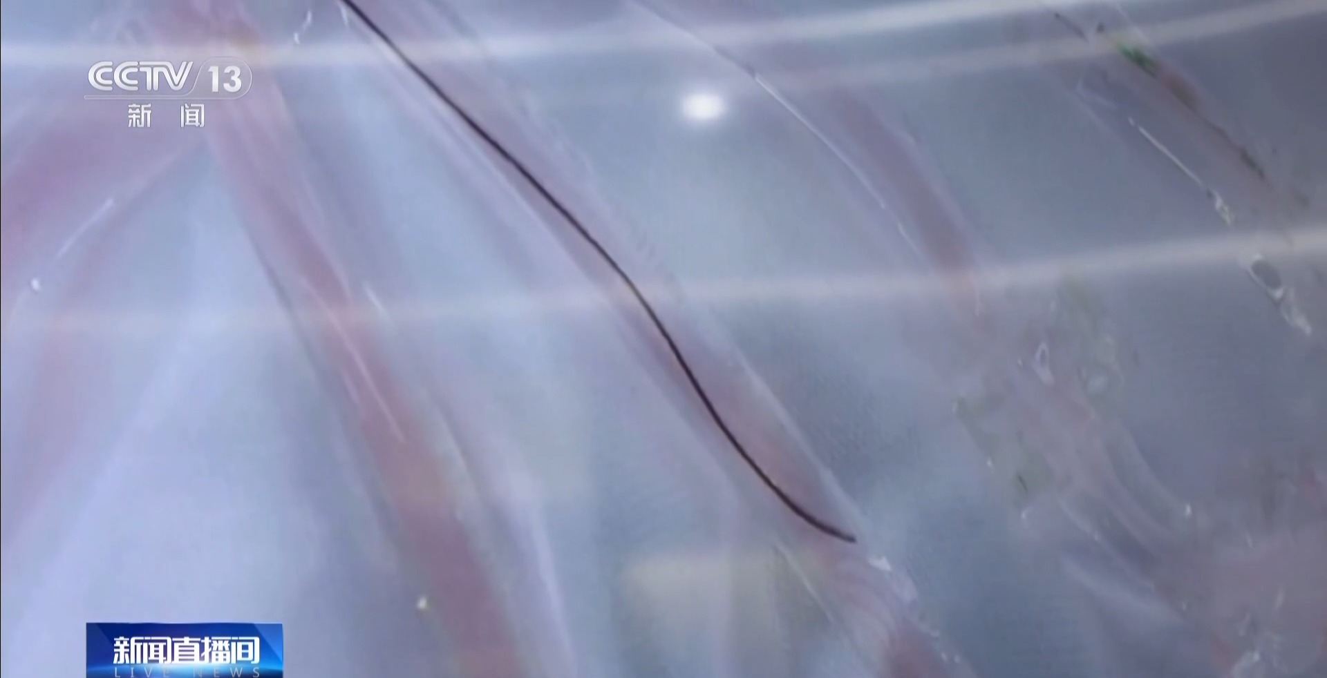 “超级助手”来帮忙AI买球网站:让深圳医疗效率“起飞”(图2)